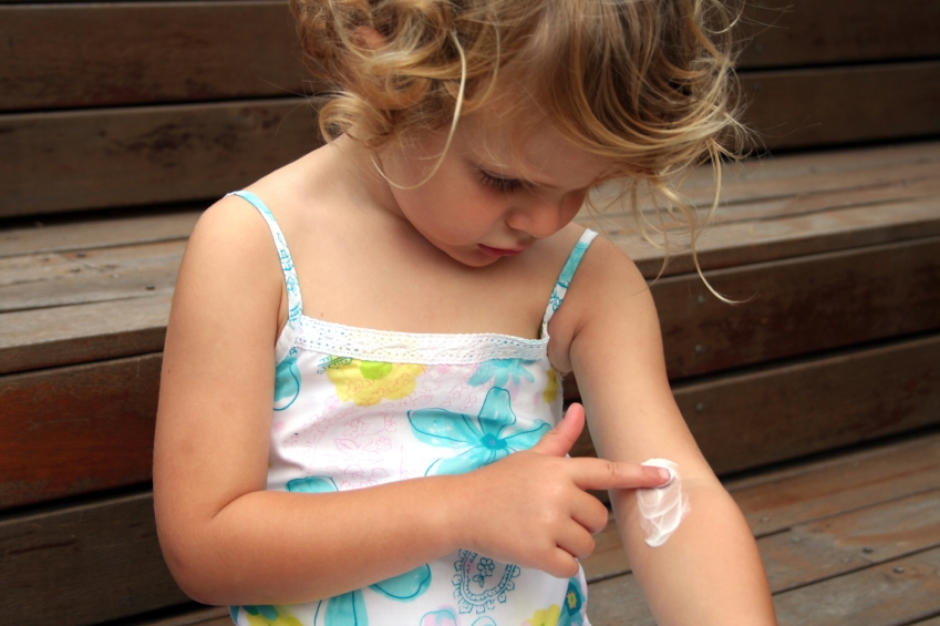How to Treat Eczema | seborrheic dermatitis | Skin Rashes that Itch